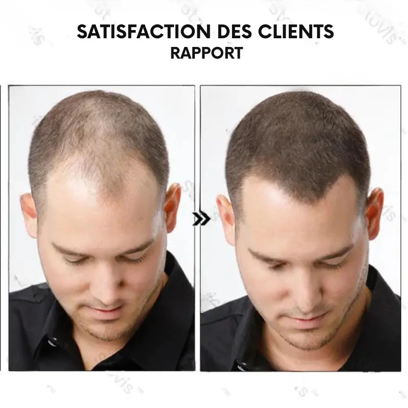 Soin de Repousse Capillaire Naturelle en 7Jours